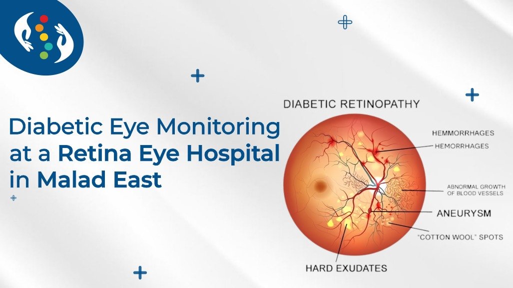 Meibomian Gland Dysfunction (MGD) — specialist eye care at Sentra Clinic & Hospital, Mumbai